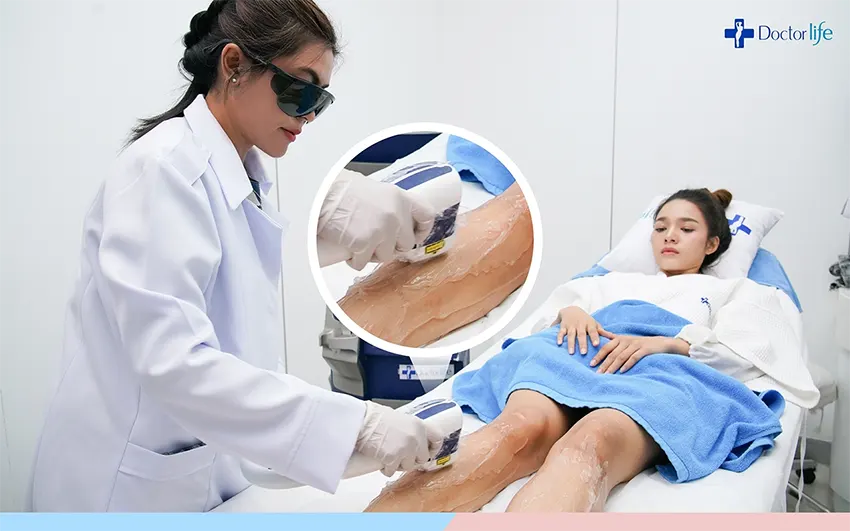 เลเซอร์กำจัดขา เรียวสวย ผิวเรียบเนียน และไร้ขน