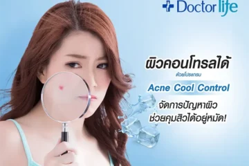 Acne cool control จัดการปัญหาผิว