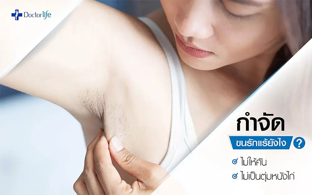 กำจัดขนรักแร้ยังไง ไม่ให้คัน ไม่เป็นตุ่มหนังไก่