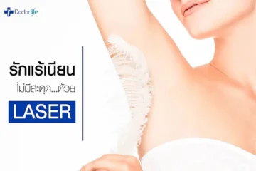 รักแร้เนียนไม่มีสะดุดด้วย Laser