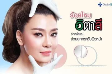 ร้อยไหมอิตาลี อีกหนึ่งวิธีที่ช่วยยกกระชับใบหน้า