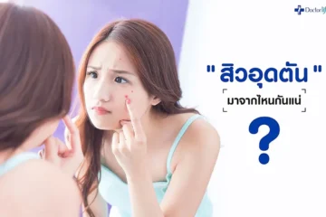 สิวอุดตัน มาจากไหนกันแน่