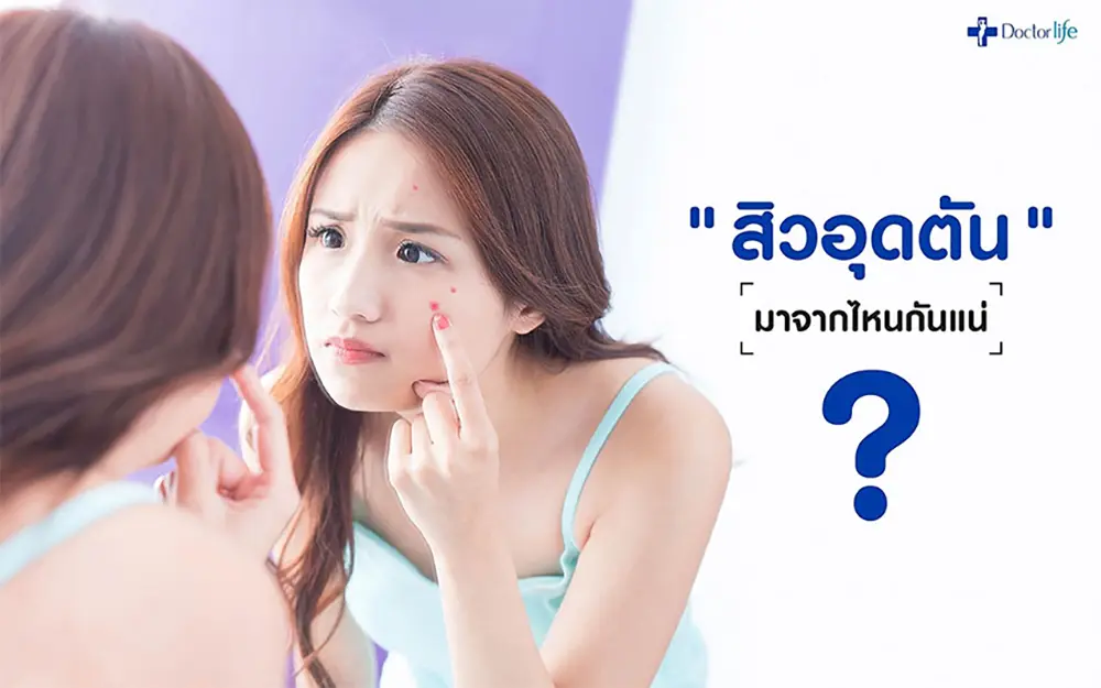 สิวอุดตัน มาจากไหนกันแน่