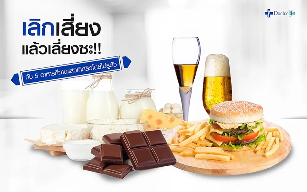 เลิกเสี่ยงแล้วเลี่ยงซะกับ 5 อาหารที่ทานแล้วเกิดสิวโดยไม่รู้ตัว