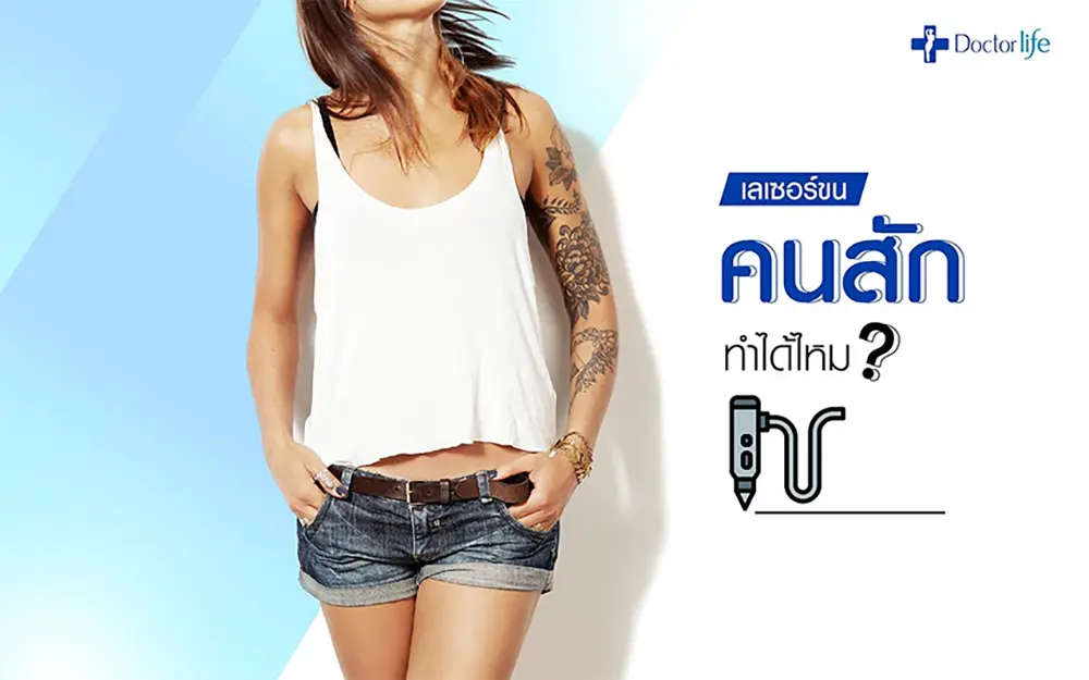 เลเซอร์ขนหรือกำจัดขนถาวรคนสักทำได้ไหม