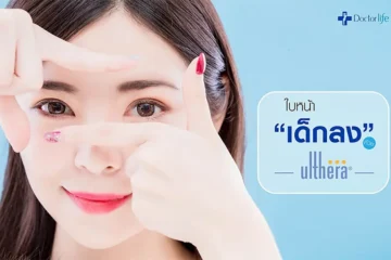 ใบหน้าเด็กลงด้วย Ulthera