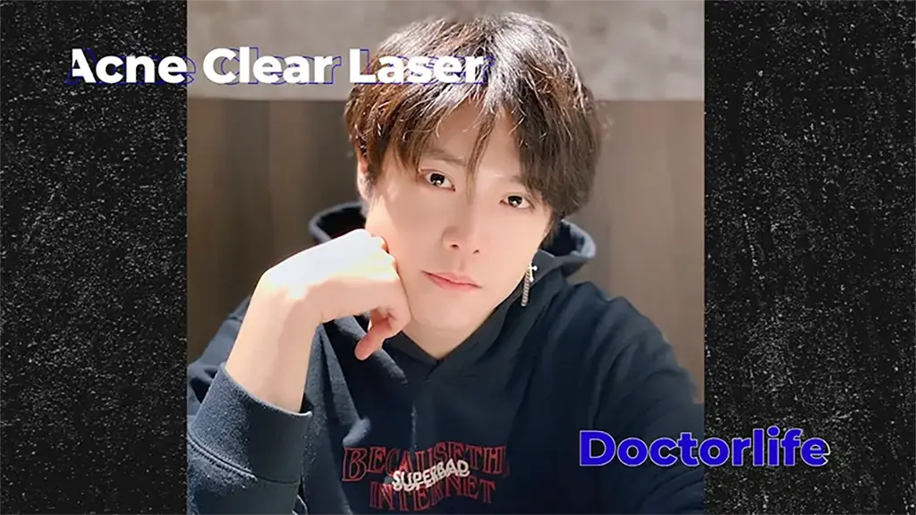 acne clear laser การรักษาสิวด้วยการเลเซอร์สิว