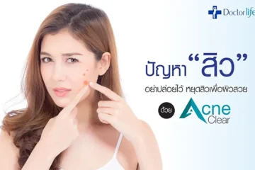 หยุดปัญหาสิวเพื่อผิวสวยด้วย acne clear laser