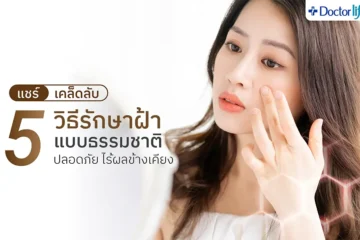 5 วิธีรักษาฝ้าแบบธรรมชาติ 01