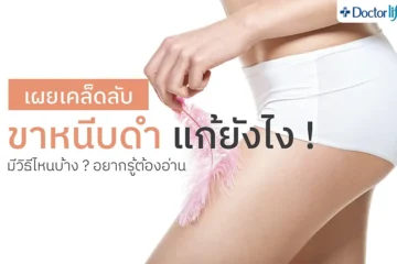 ขาหนีบดำ ง่ามขาดำ ปัญหาความหมองคล้ำในจุดลับ