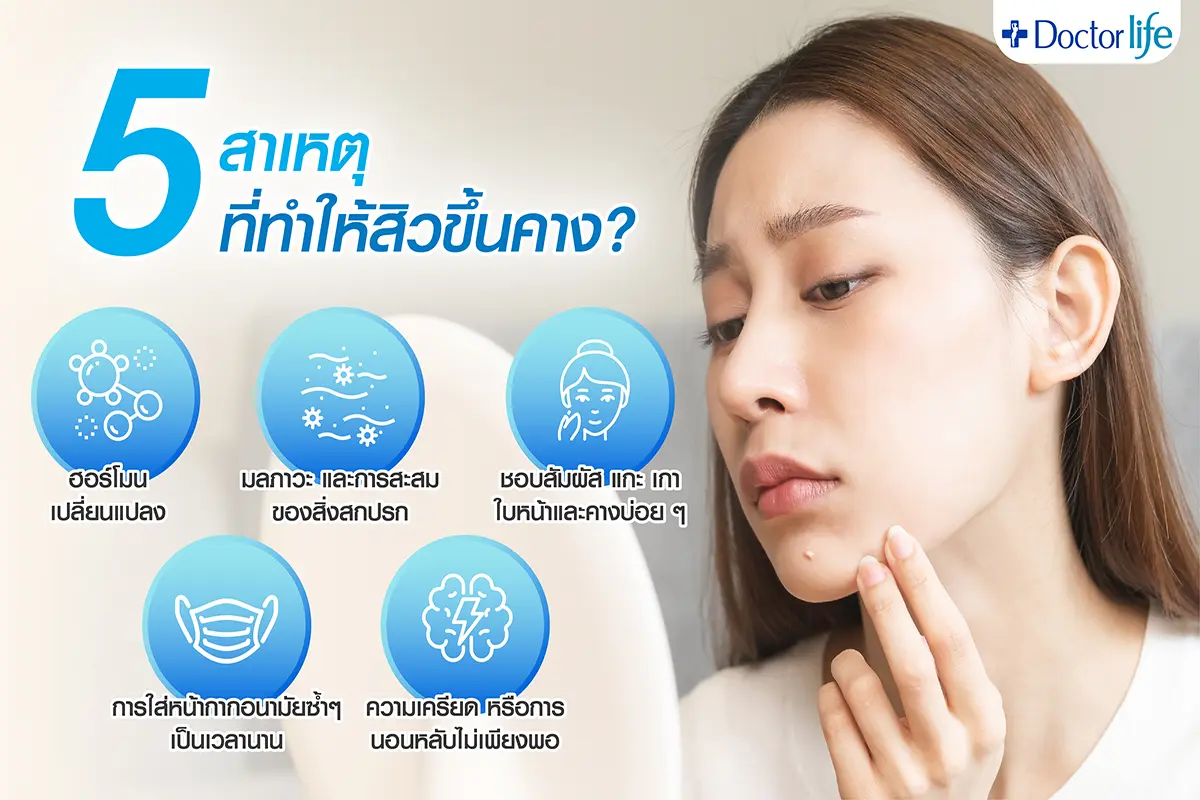 5 สาเหตุที่ทำให้สิวขึ้นที่คาง เกิดจากอะไร ?