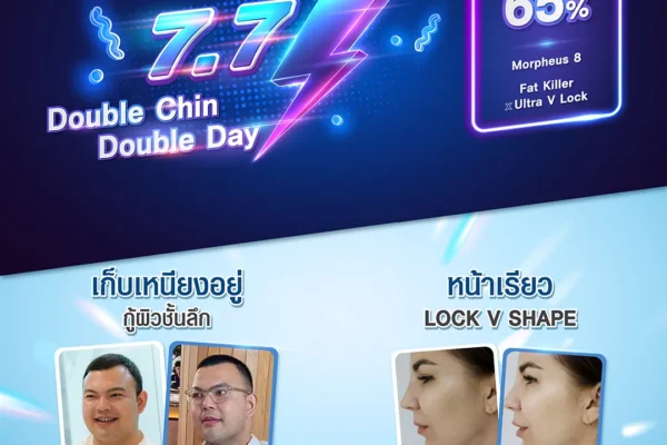 04 07 67ddchinday 04