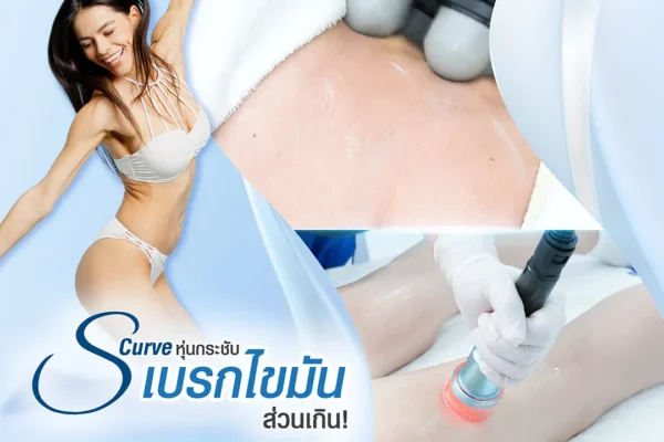 05 07 67 s curve เบรกไขมัน (4)