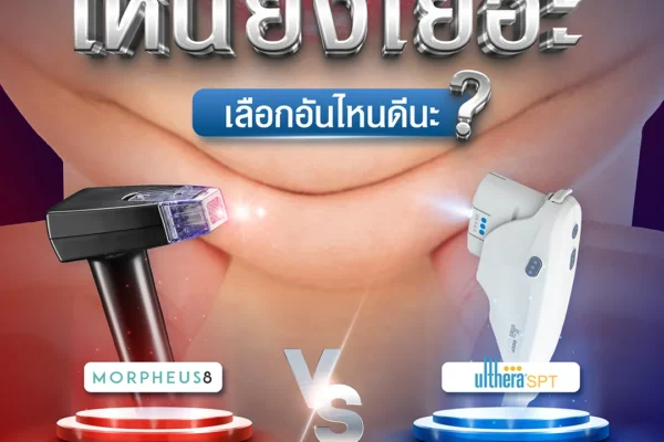 31 07 67 morpheus8 ulthera spt เหนียงเยอะ เลือกอันไหนดี (2)