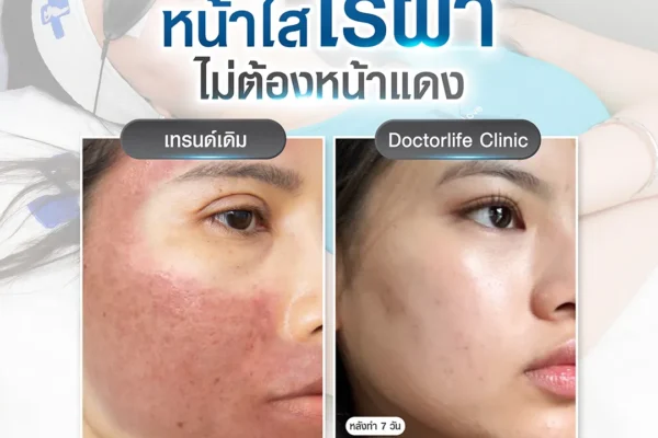 01 08 67หน้าใสไร้ฝ้า