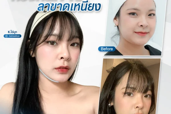 03 08 67 fat killer ทวงคืนคาง