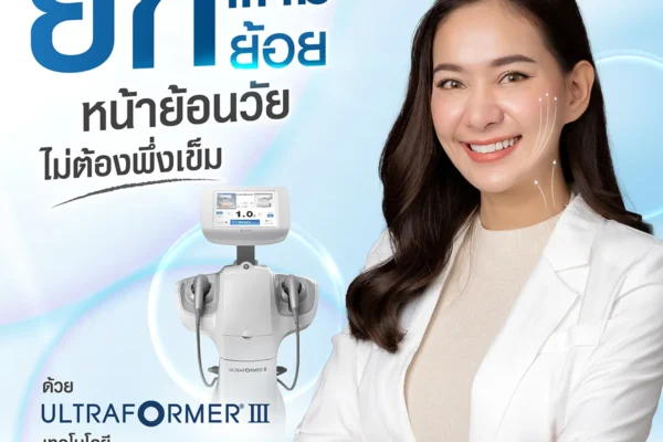  08 67 ultraformer lll ยกแก้มย้อย