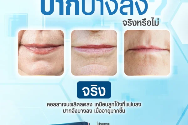 14 08 67 filler ปาก อายุมากขึ้นปาก