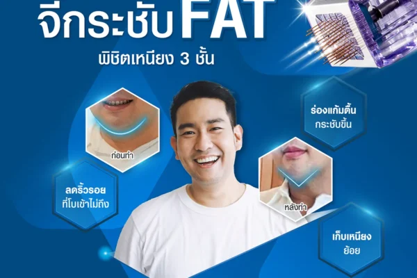 14 08 67 morpheus8 จี้กระชับ