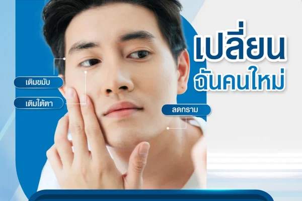 Botolinum Toxin + Filler เปลี่ยนฉันคนใหม่